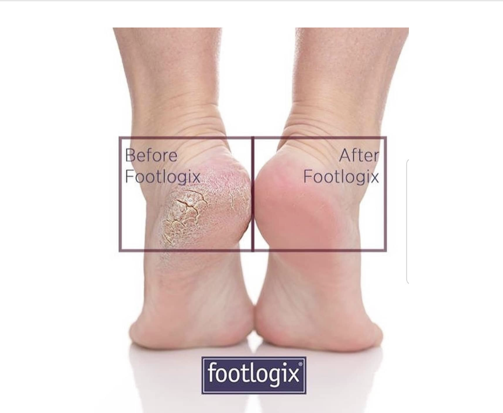 Footlogix Double-sized course-fine Stainless Steel