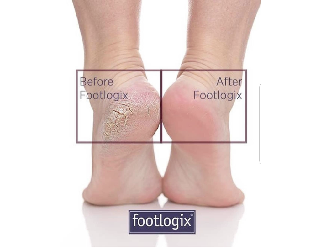 Footlogix DD Cream Mousse