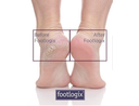 Footlogix DD Cream Mousse