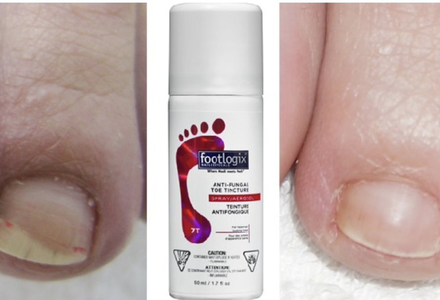 Footlogix Toe Nail Tincture